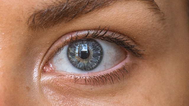Astaxanthine et sécheresse oculaire